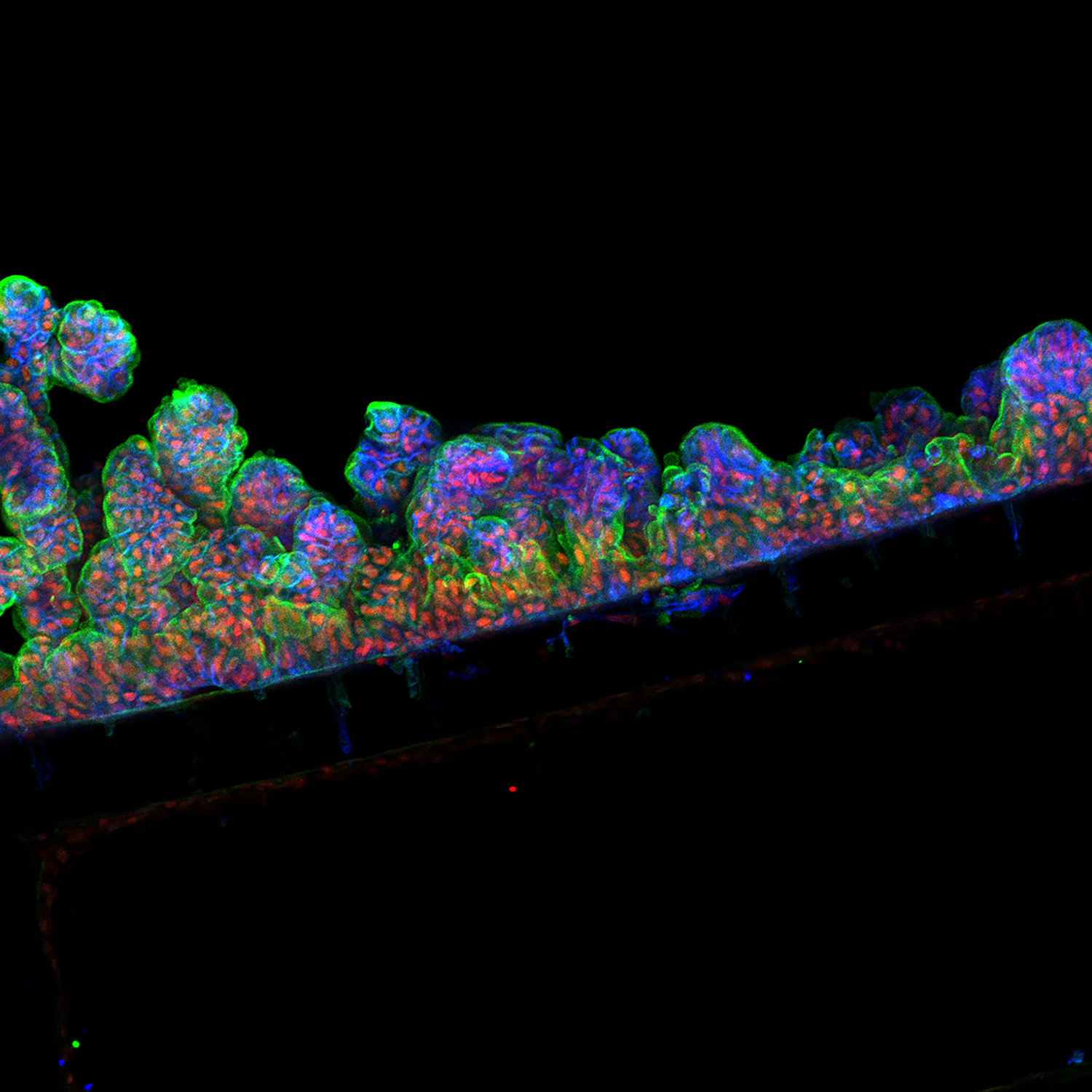 Cells from a person’s intestinal lining, placed in one of Emulate Inc.’s devices, form intestinal folds as they would in the human body.