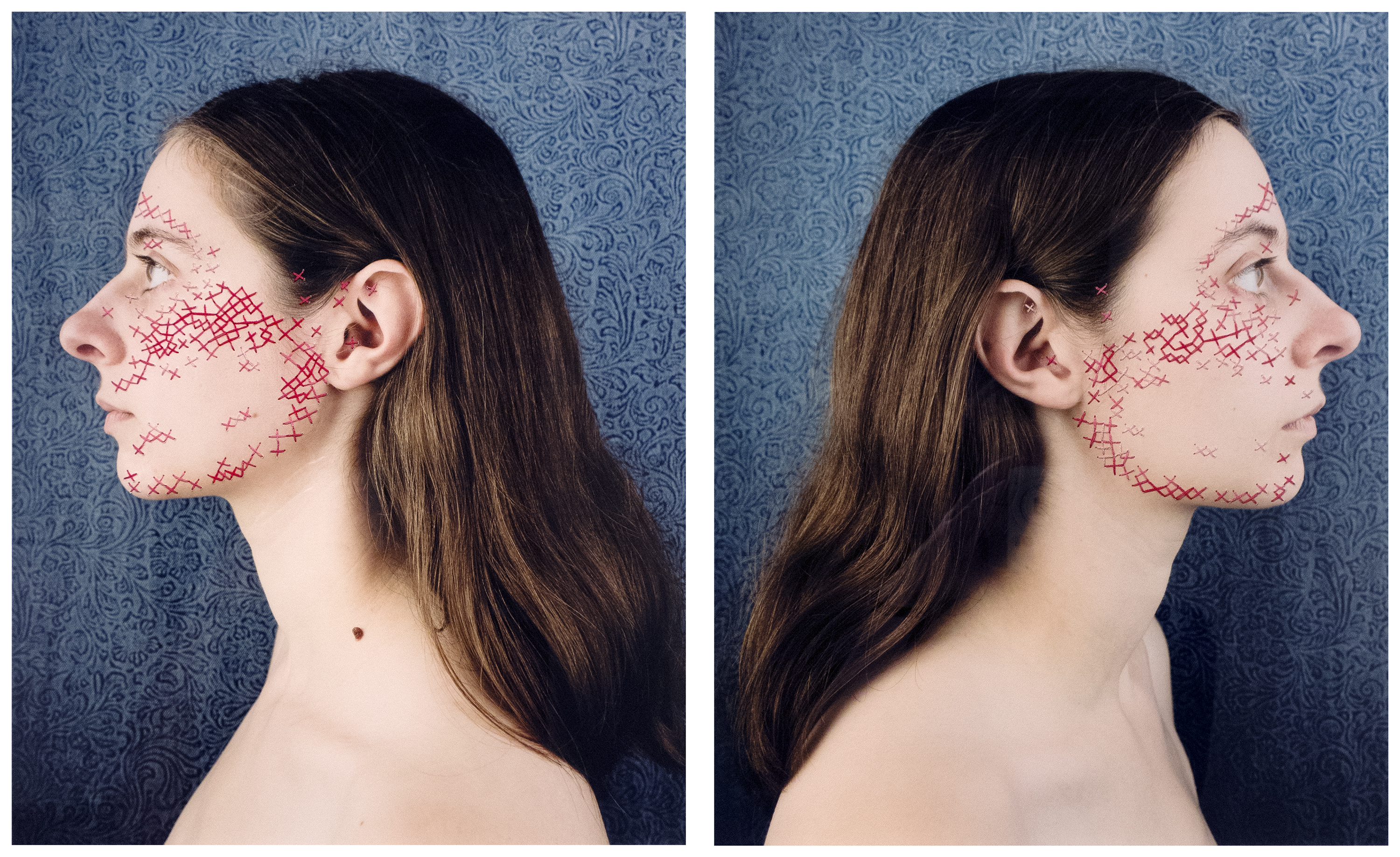 Suzi Grossman’s “Mark the X Where Your Face Hurts” in “Performing Illness” group show.