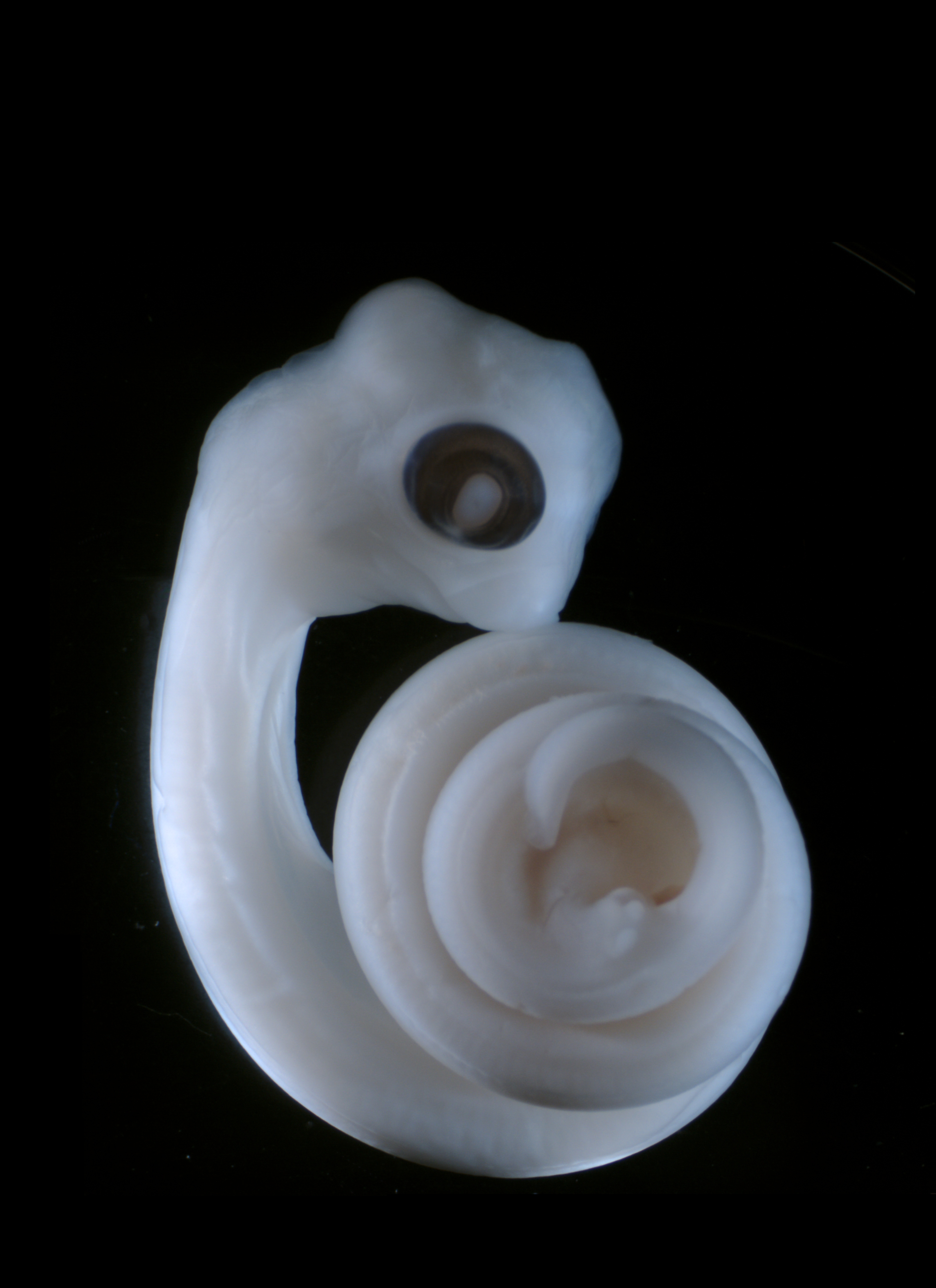 A python embryo with budding genitals and vestigial limb-buds.