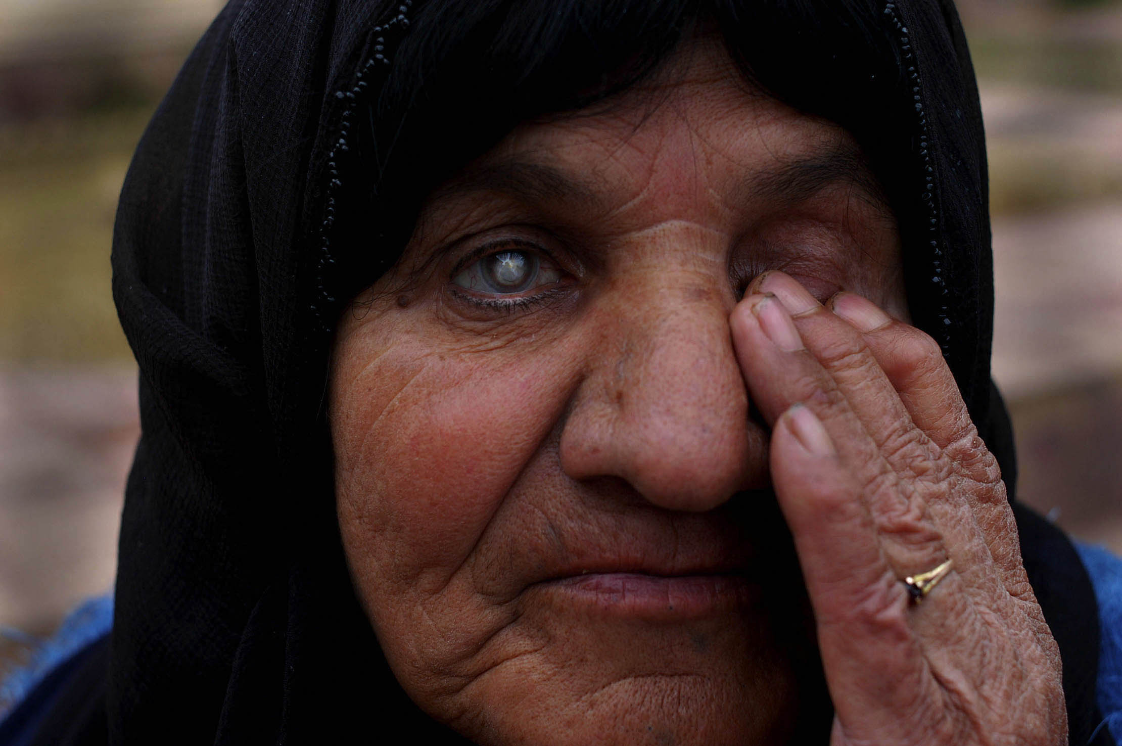 A 60-year-old woman is blind in her right eye as a result of the 1988 chemical attack on Halabja, when Iraqi war planes dropped bombs and shelled the Kurdish town.