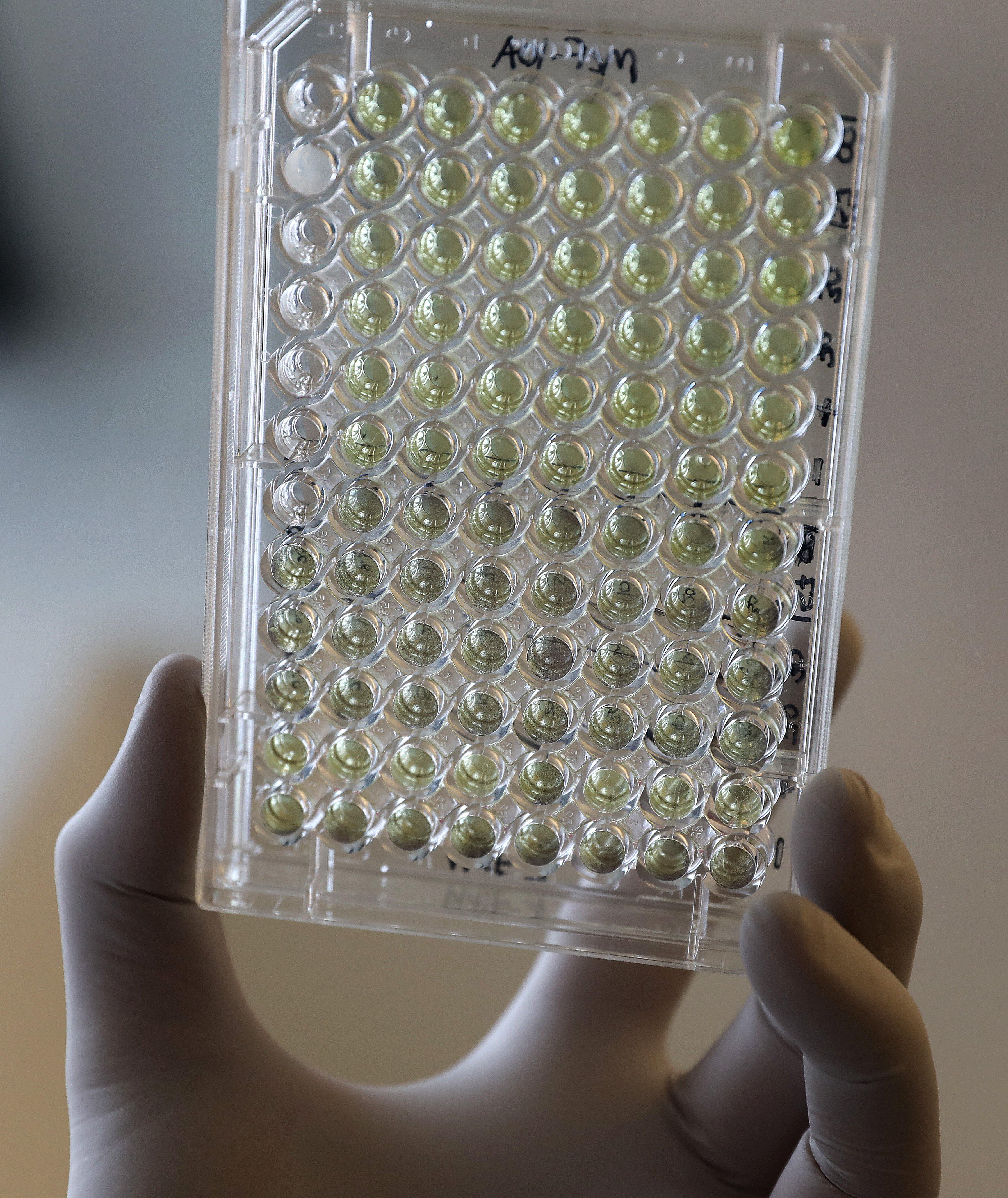 A 96-well assay plate.