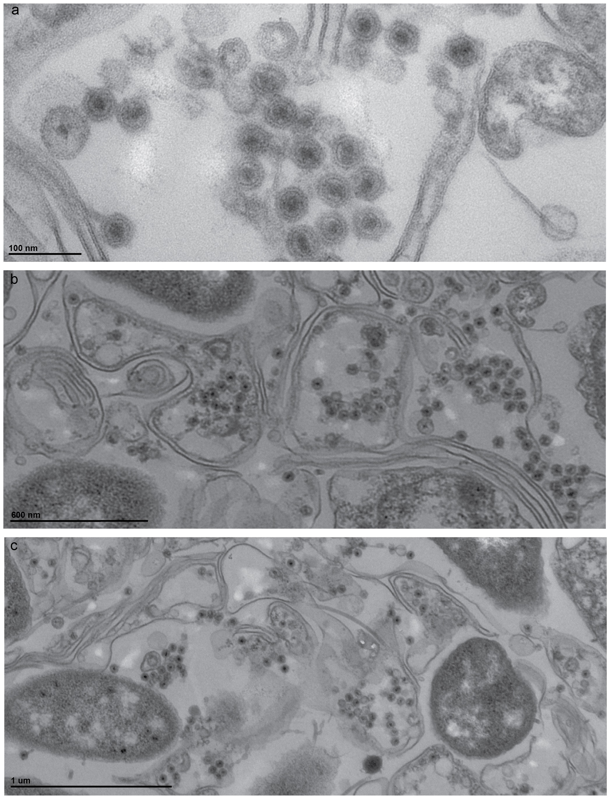 Electron microscope images of marine bacteria infected with the newly discovered viruses. The bacterial cell walls are seen as long double lines. The viruses are the small round objects with dark centers.