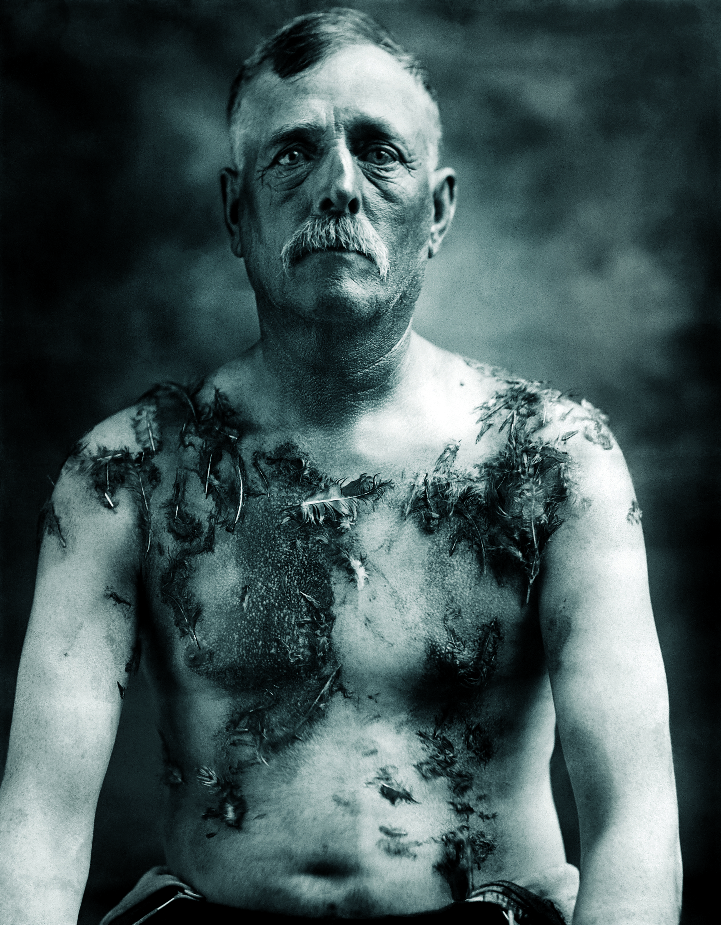 In August 1918, amid anti-German sentiment during World War I, German-American farmer John Meints was taken from his home in Luverne, Minn., and driven to the South Dakota border where he was whipped and tarred-and-feathered by masked locals.