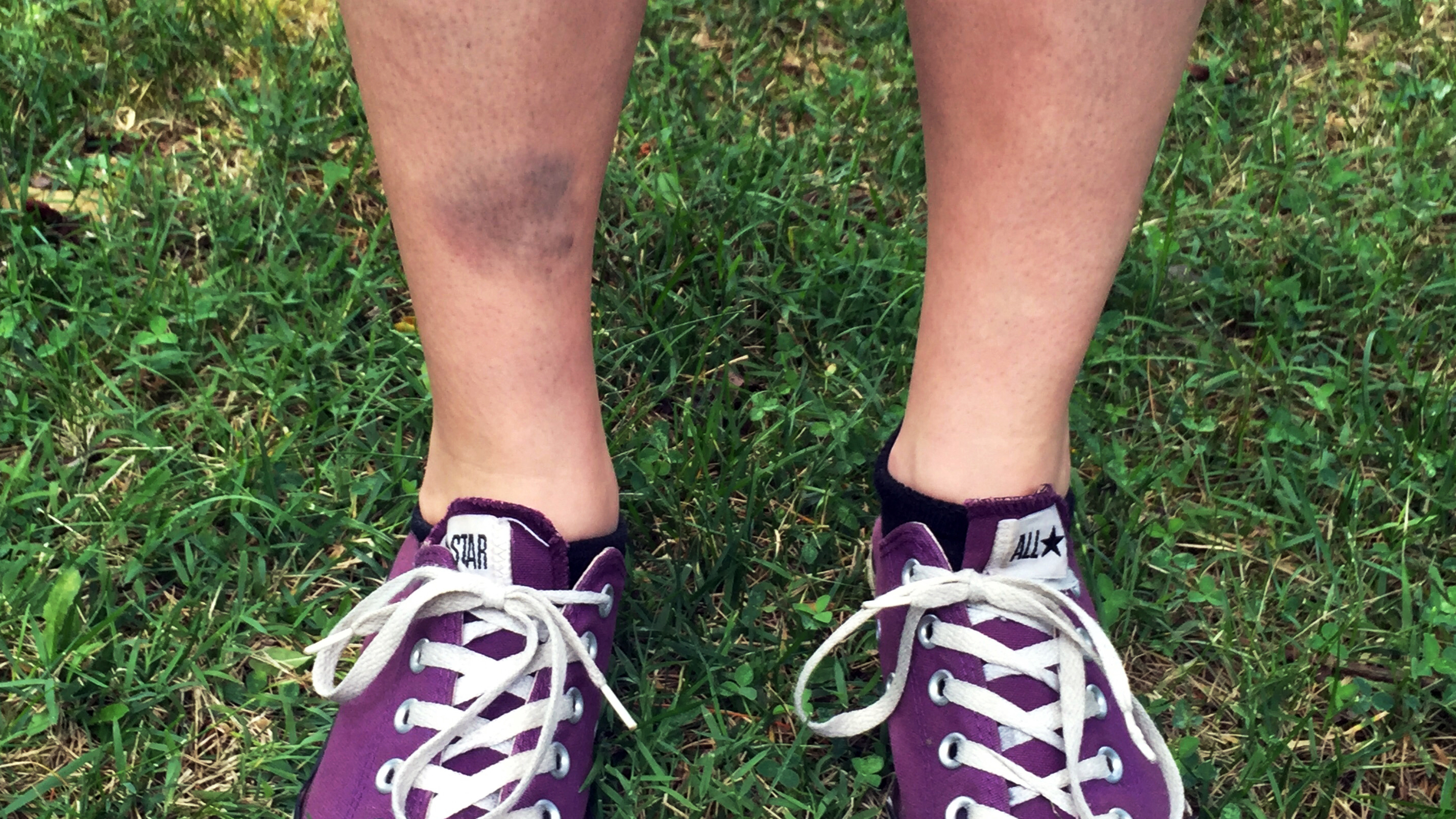 Lindsay Plunkett, a 23-year-old waitress in Asheville, N.C., tripped over a cinder block that had been used as a doorstop while playing Pokémon Go.