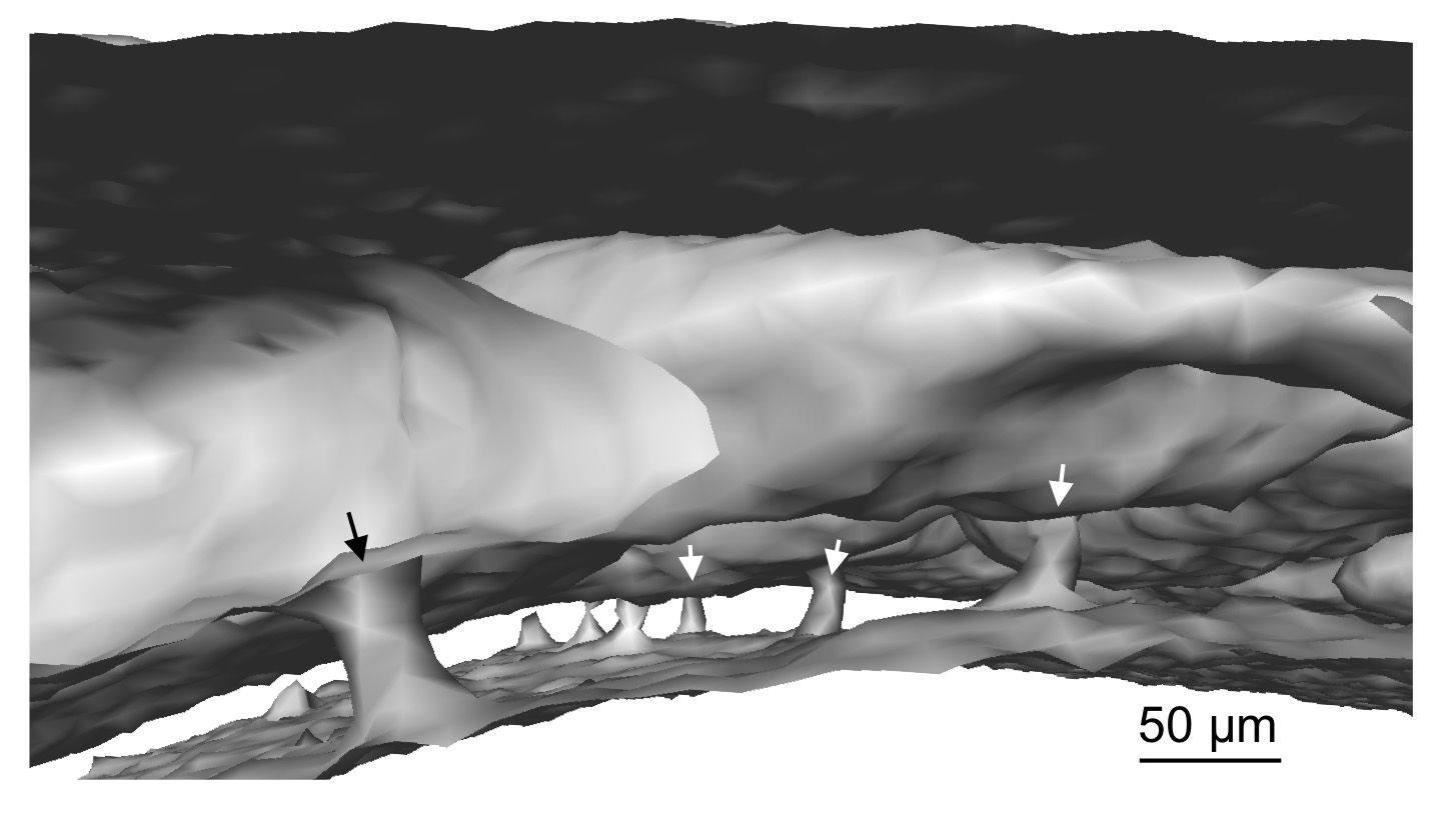A micro-CT scan of the skull of a living mouse shows the channels coming from the bone marrow to the outer membranes of the brain.