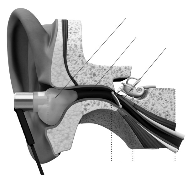 Lantos’ earbuds are tailored to fit your ear canal.