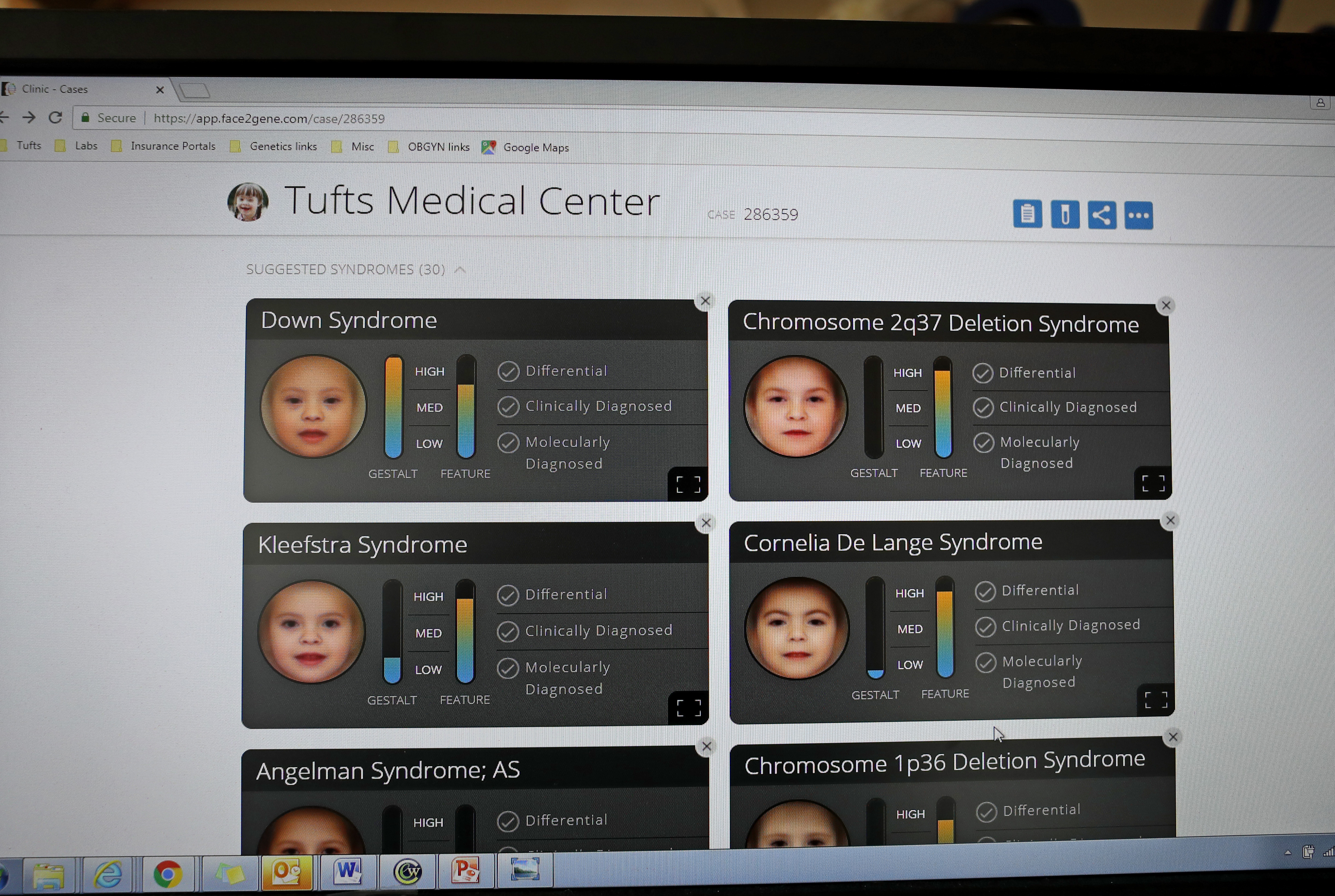 Face2Gene was developed by Boston-based digital health startup FDNA.