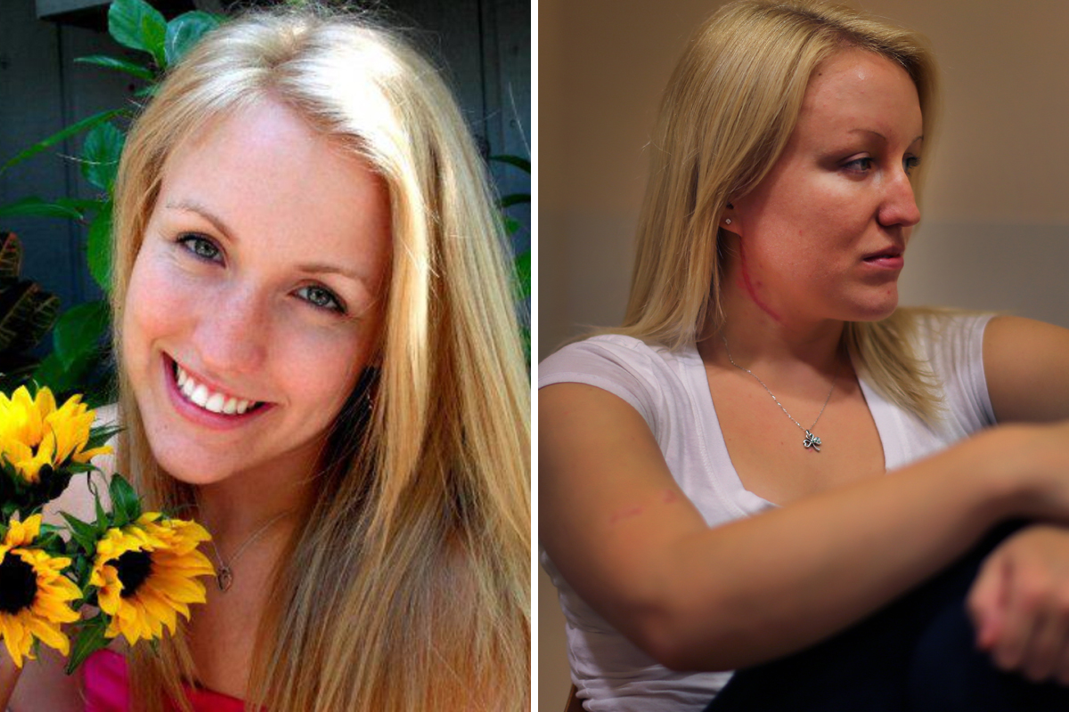Melissa Dohme (left), before the 2012 stabbing attack. Mass Eye and Ear and MGH have aided her recovery.