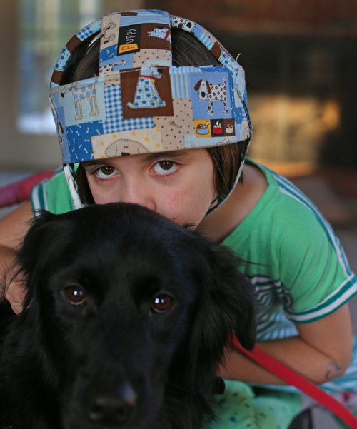 Haley wears a helmet to protect her head in seizures. Her dog, Sofie, is trained to push an alarm when seizures start.