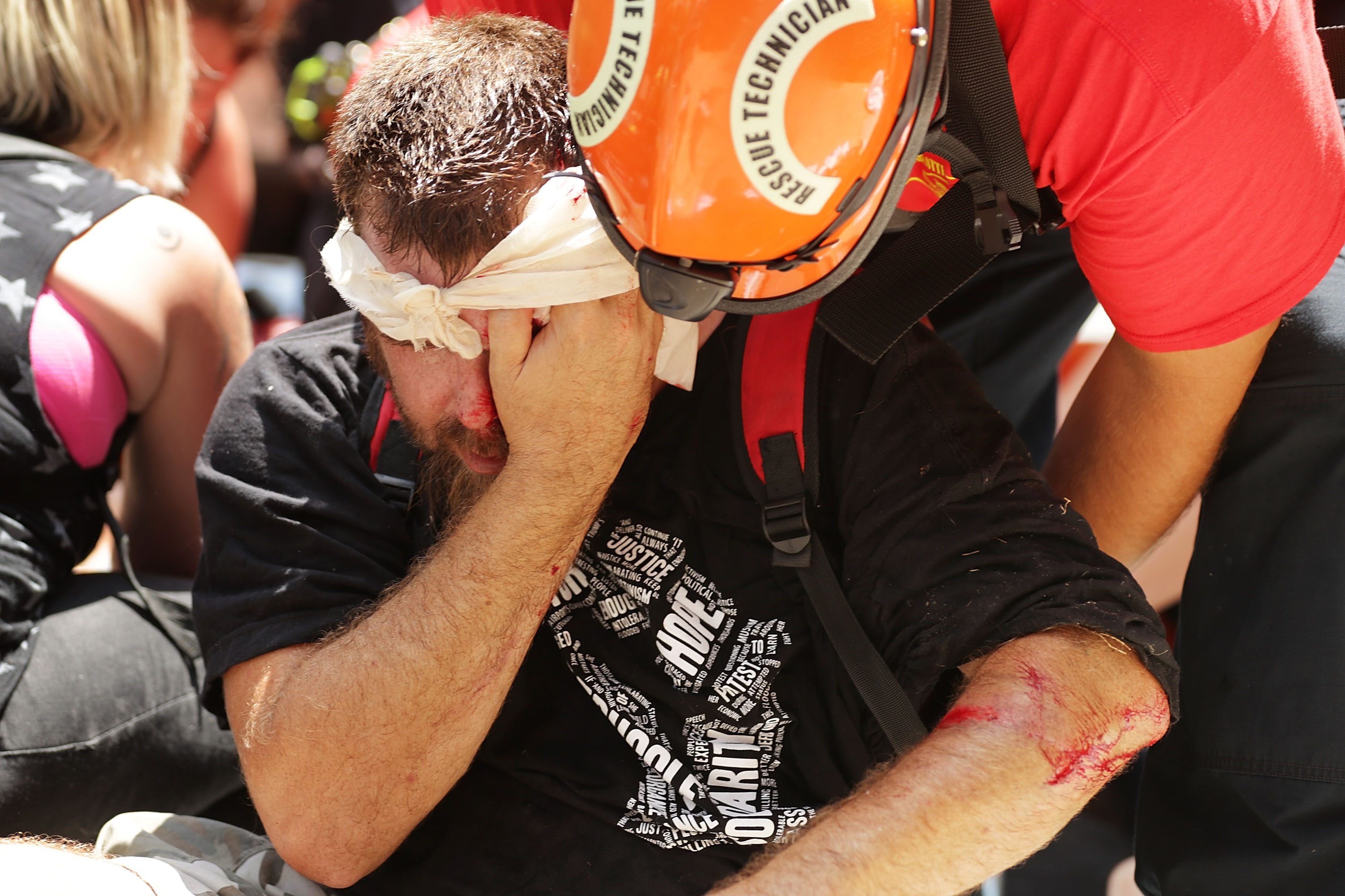 Rescue workers and medics tended to many people who were injured when a car plowed through the crowd on Saturday in Charlottesville.