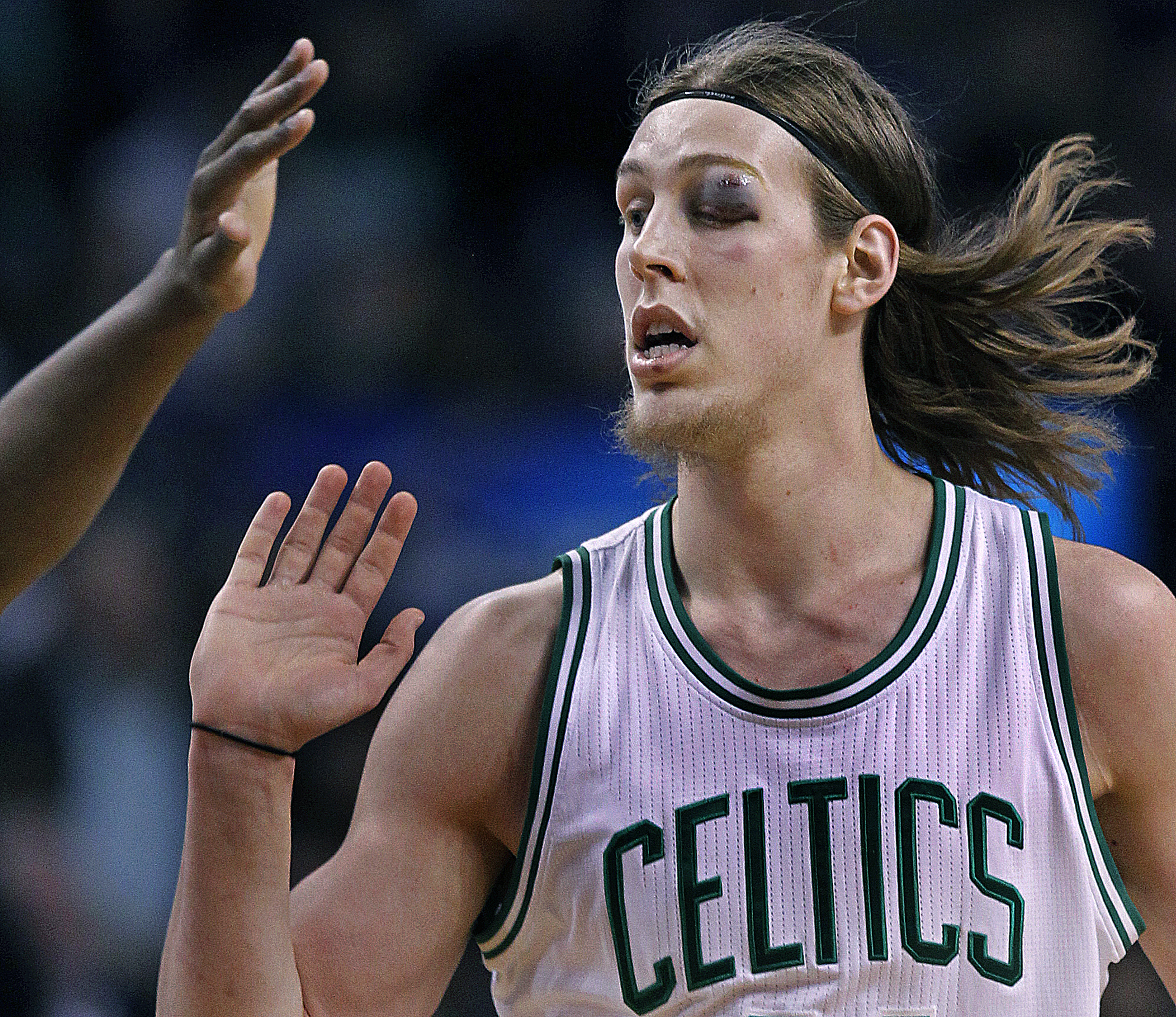 Kelly Olynyk already has needed stitches twice this month, including above his eye before a game on April 1.