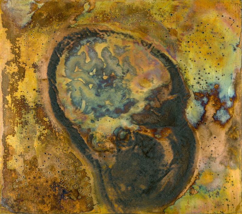 Miller’s “MRI Sagittal View of the Artist's Brain.”