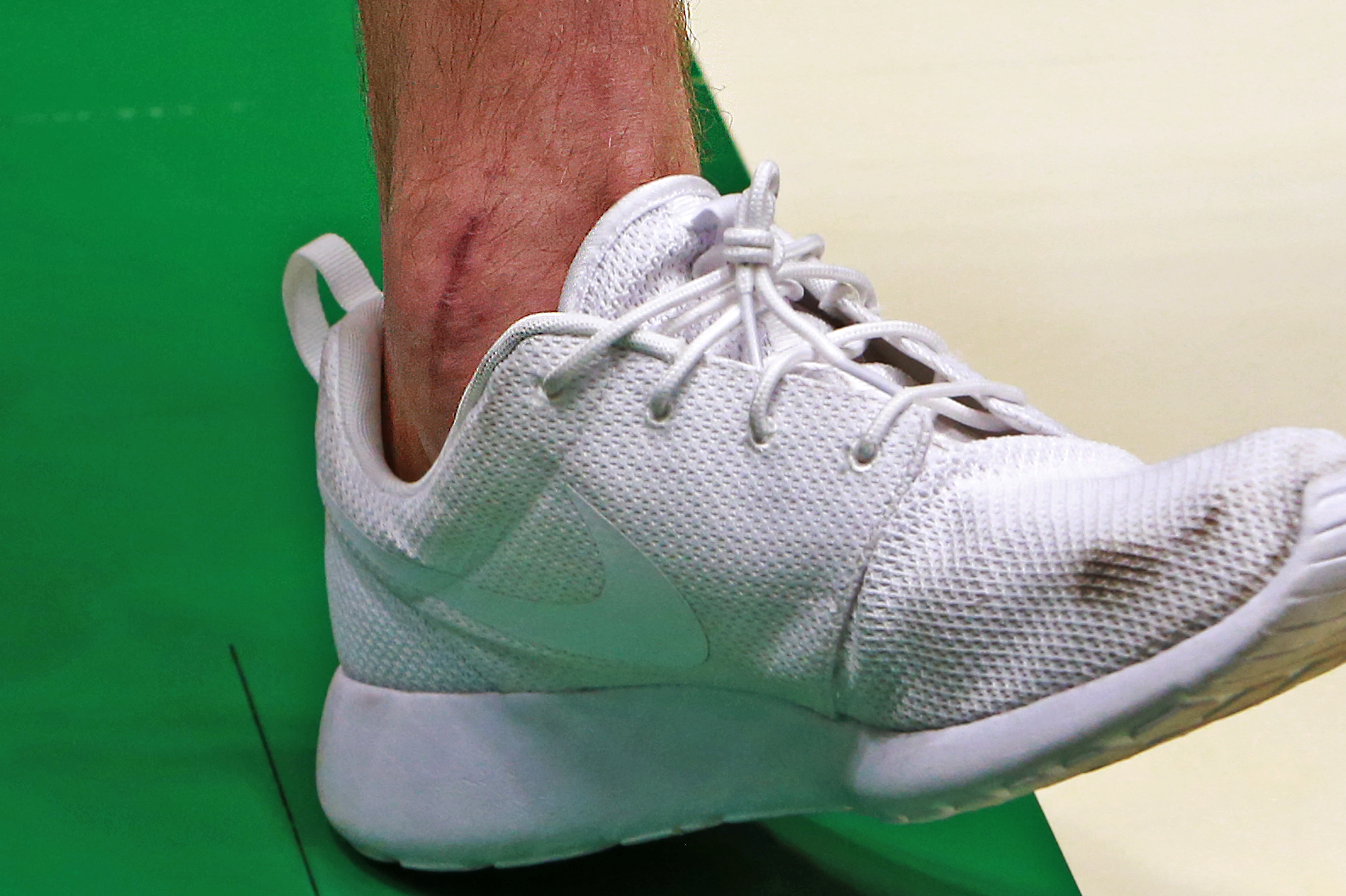 A scar was visible on Gordon Hayward’s left ankle.