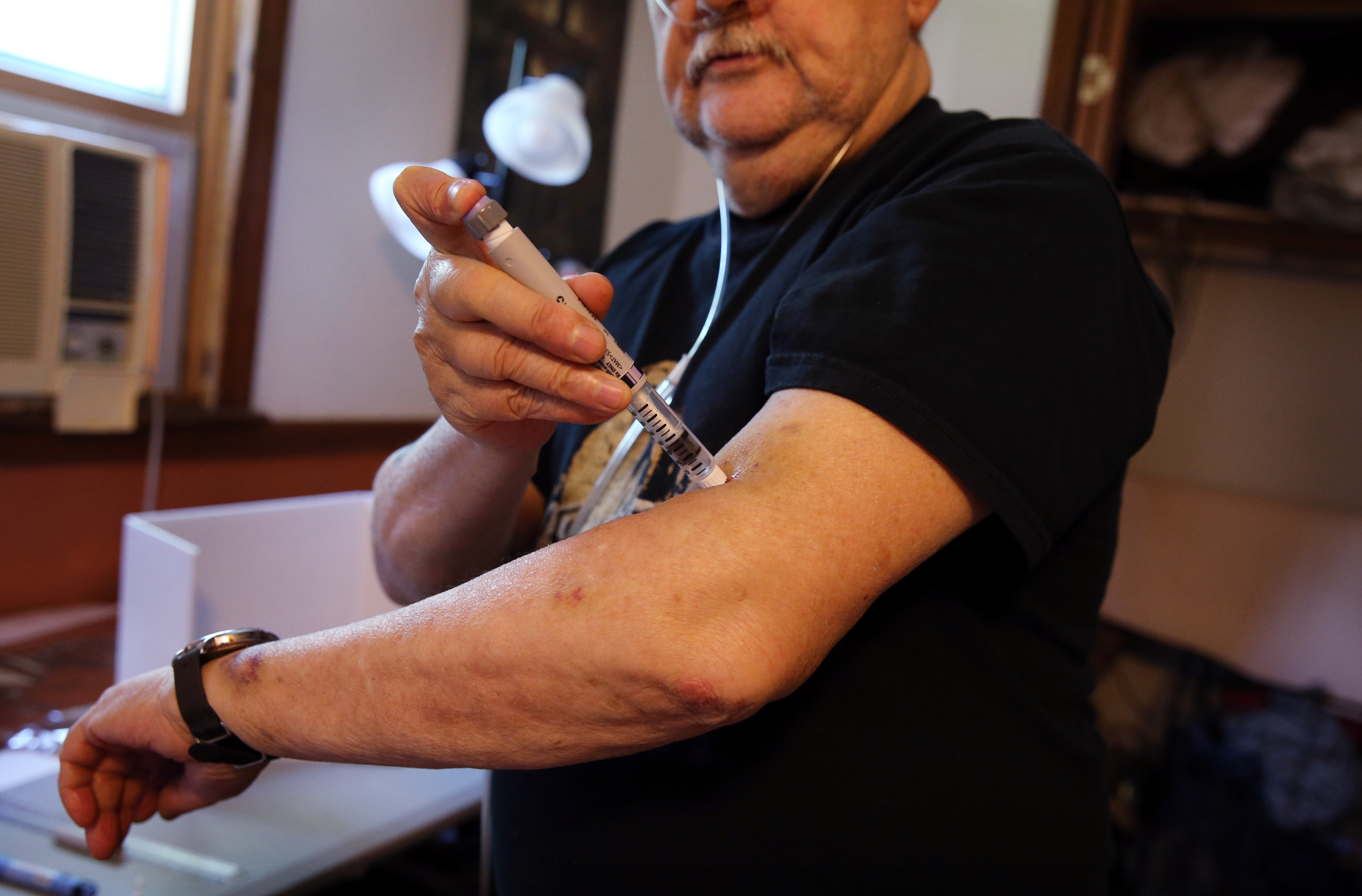 Ron, an Army veteran, injected insulin for his diabetes at his home in Nashua.