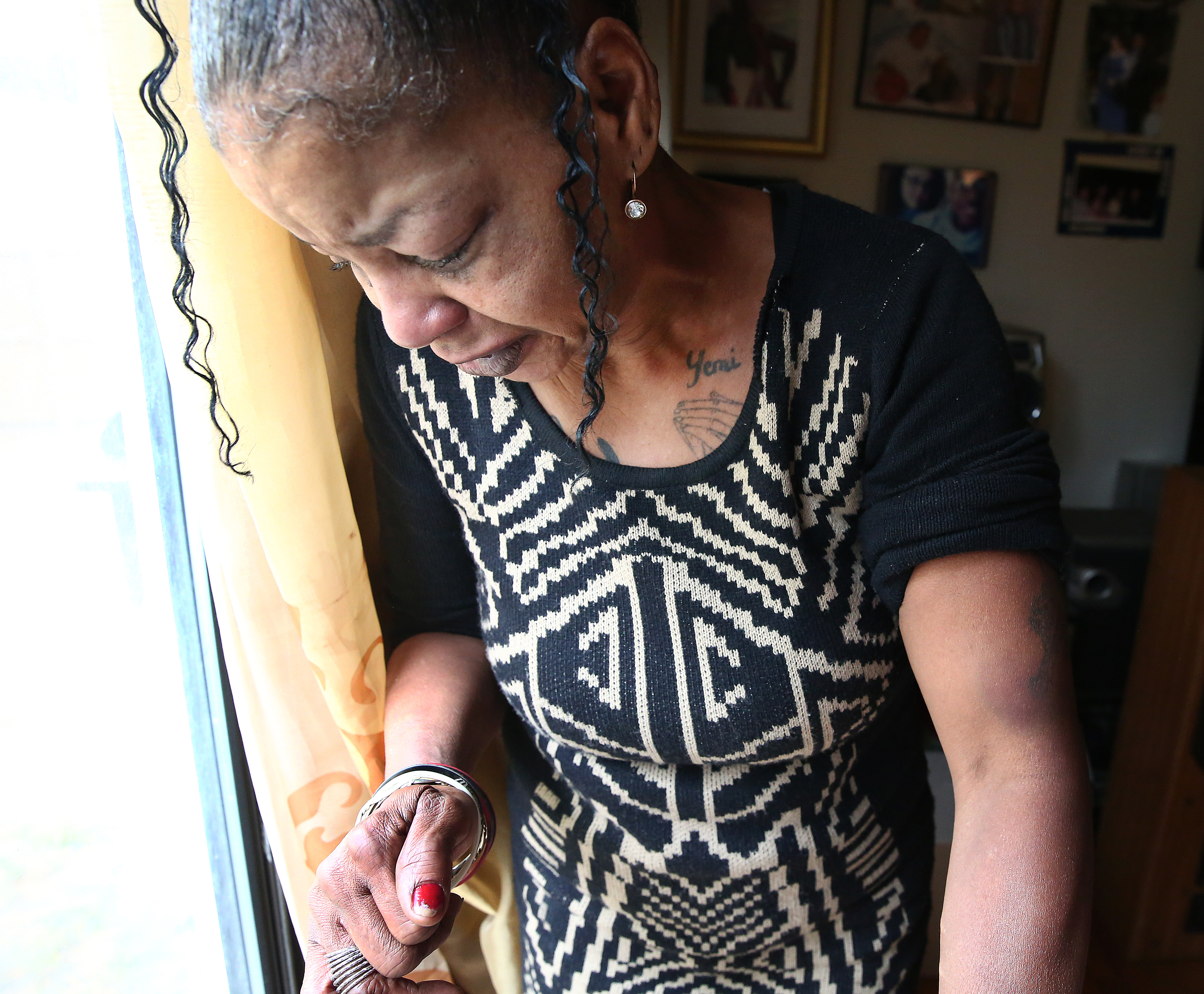 Hope Coleman said the bruise on her left arm was caused when police entered the apartment.
