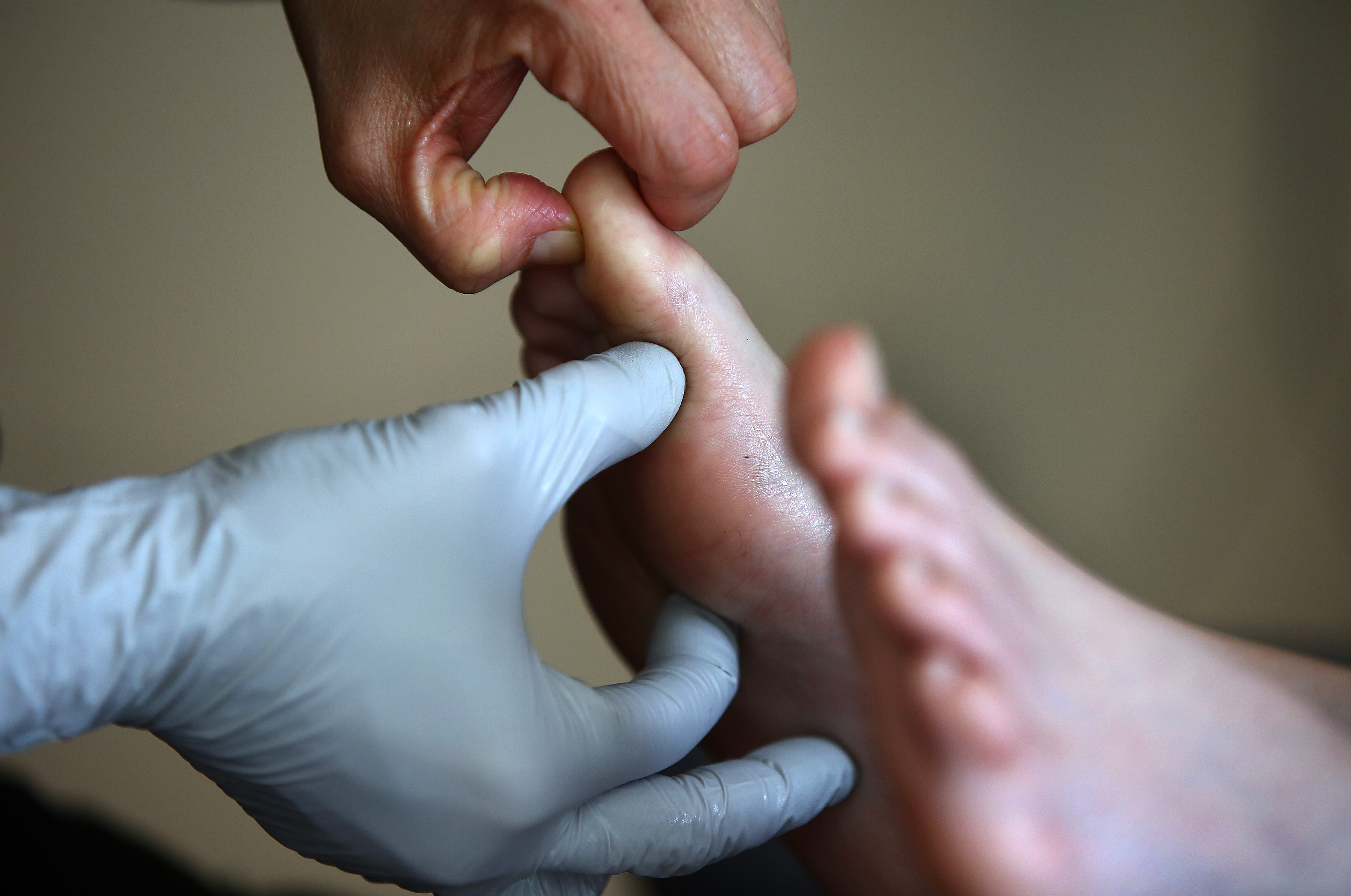 Free and complimentary reflexology therapies are offered to patients while they get chemotherapy at Dana-Farber Cancer Institute.