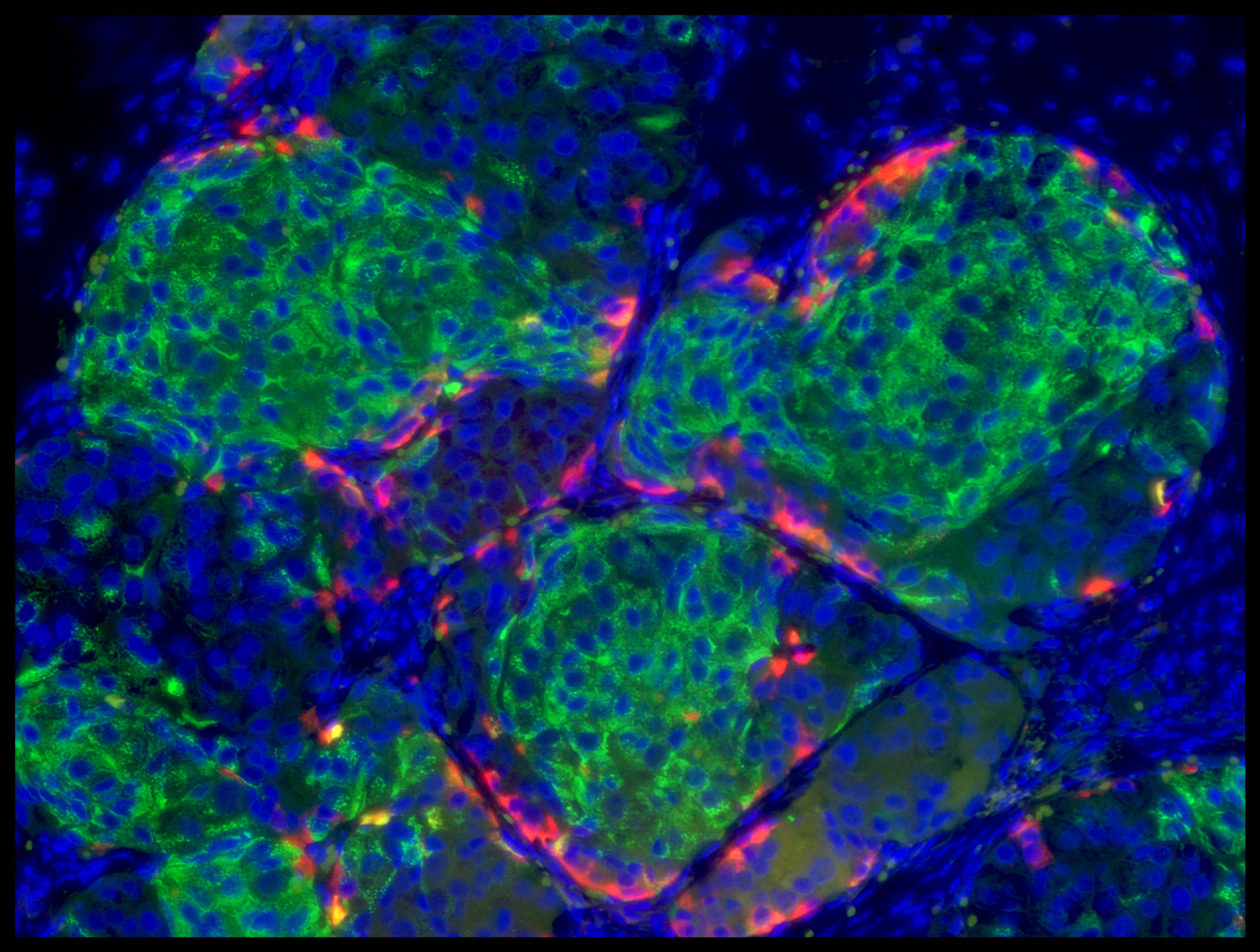 Pancreatic cells that secrete insulin.
