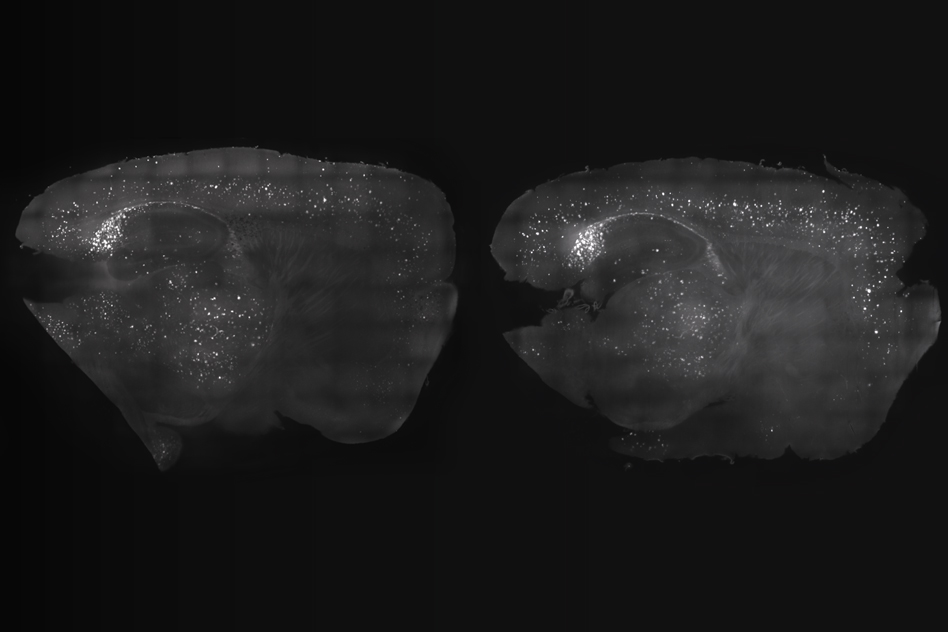 The mouse cortex (left) shows a reduction in amyloid plaques after treatment, compared with the untreated mouse (right).