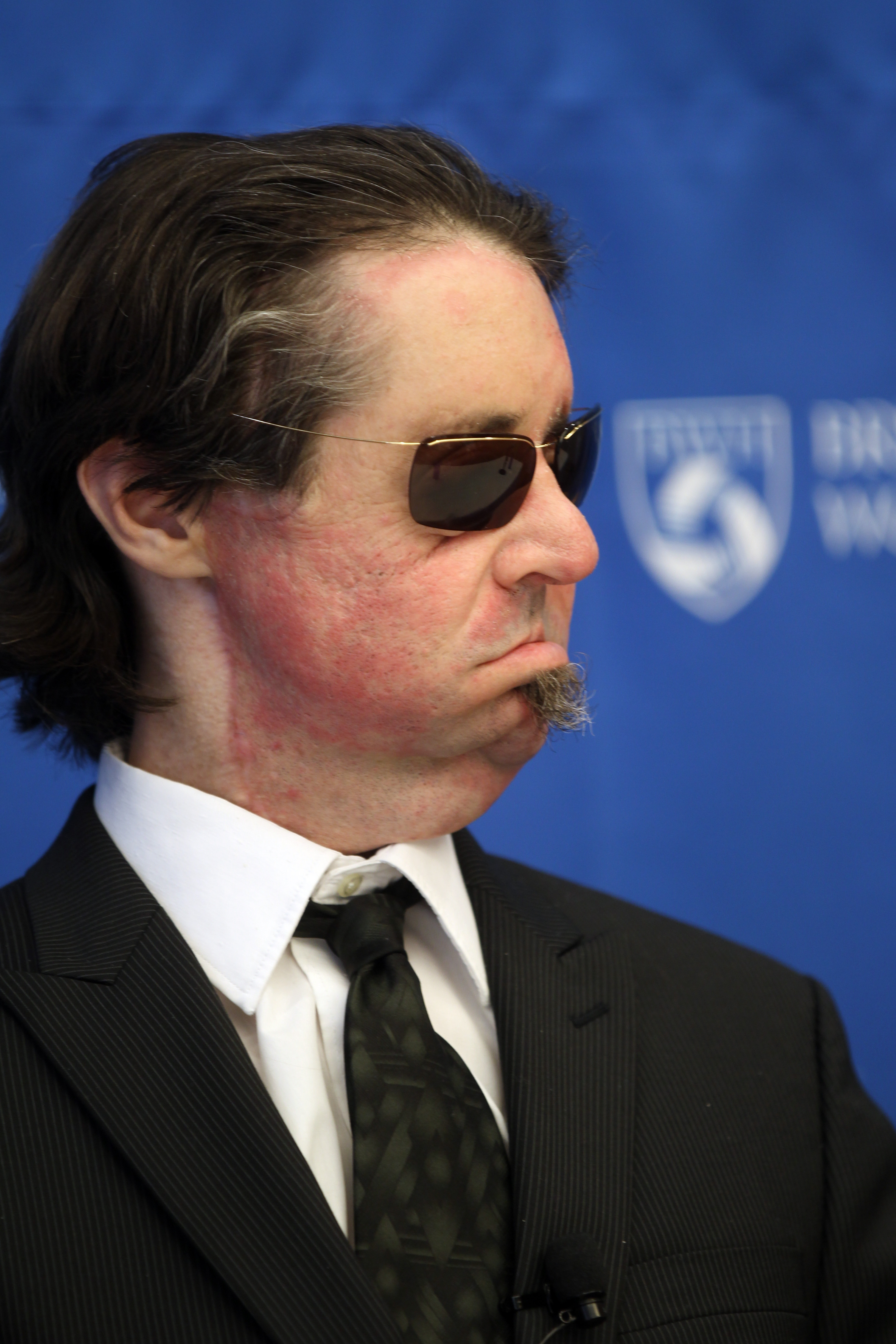 Transplant recipient Dallas Wiens in 2012 — a year after surgery.