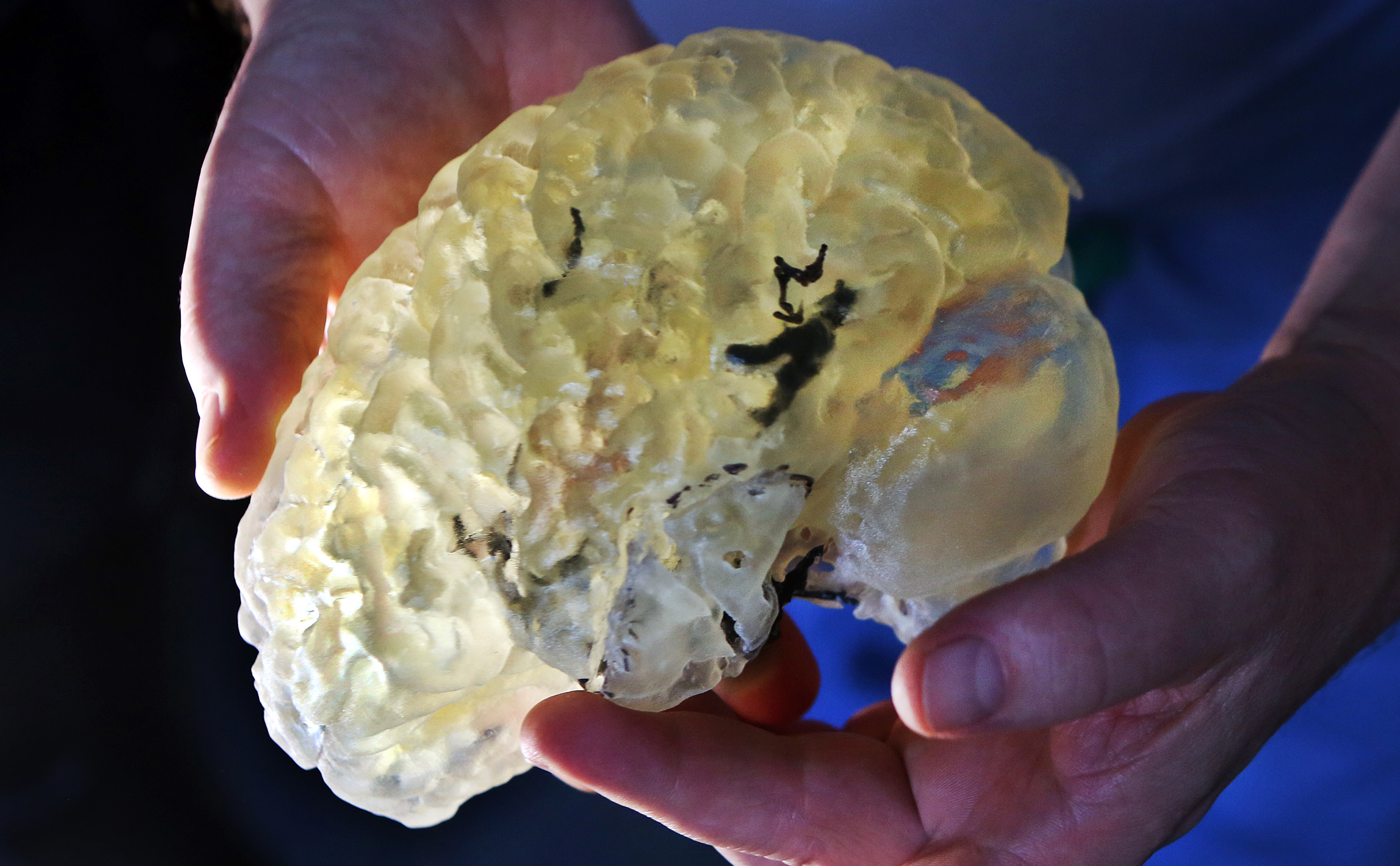 Boston Children’s Hospital’s extensive 3-D printing program for body parts such as brains lets surgeons practice on models.