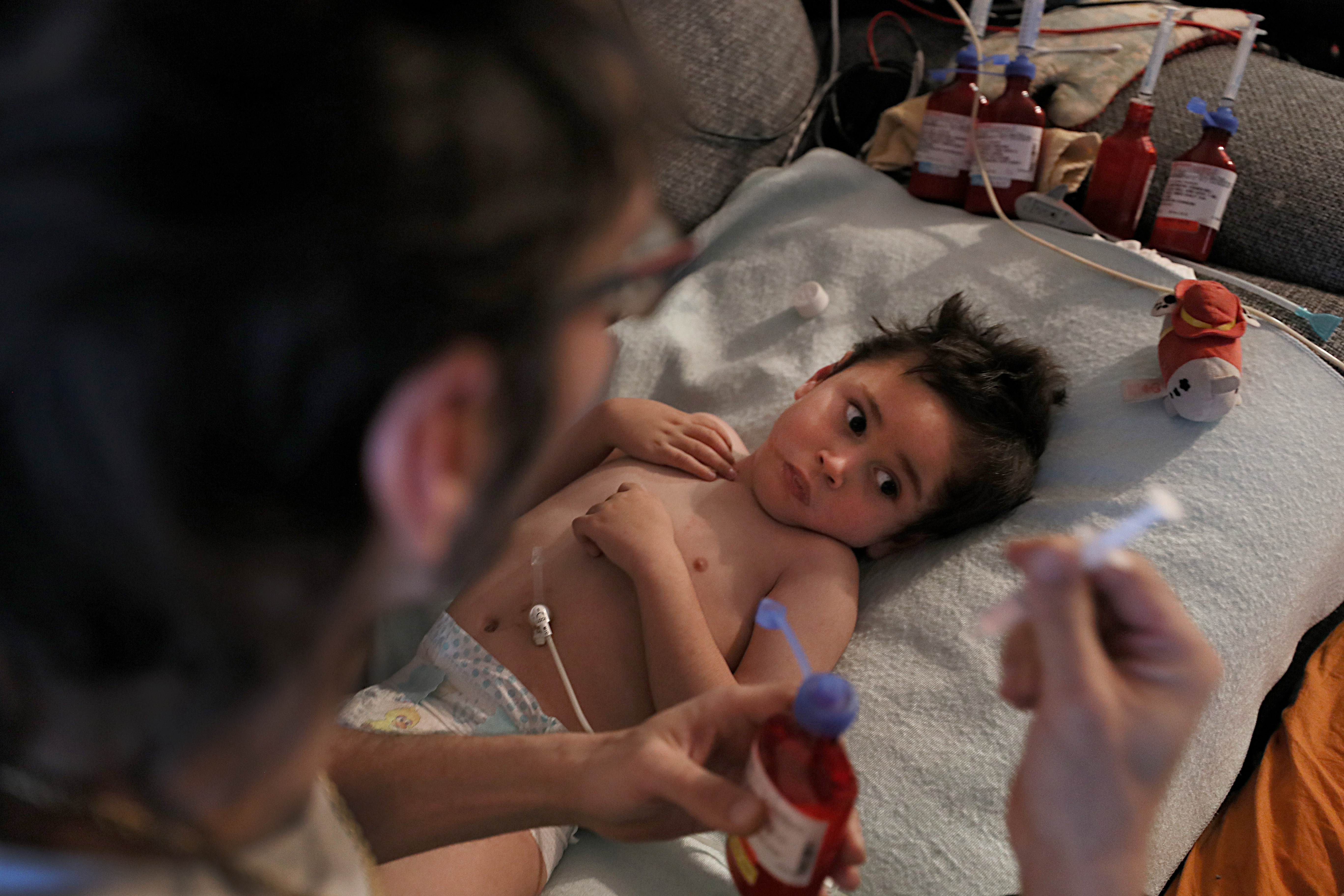 Nathan Parker delivered one of six morning medications through the feeding tube for his son Lucas.