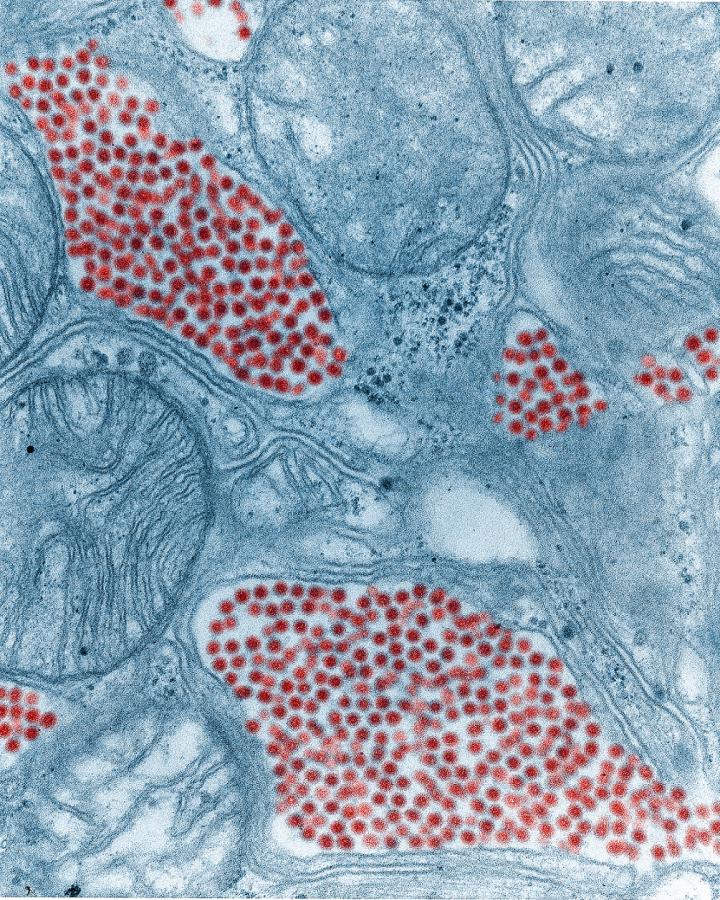 A colorized electron microscope image of mosquito salivary gland tissue. EEE virus particles are in red.