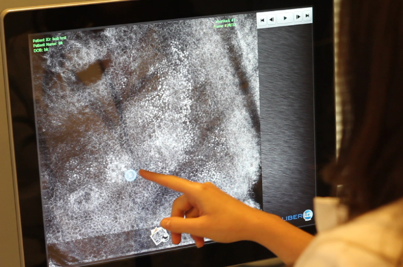 A high-resolution image from a laser scan mimics what a pathologist would see under a microscope.