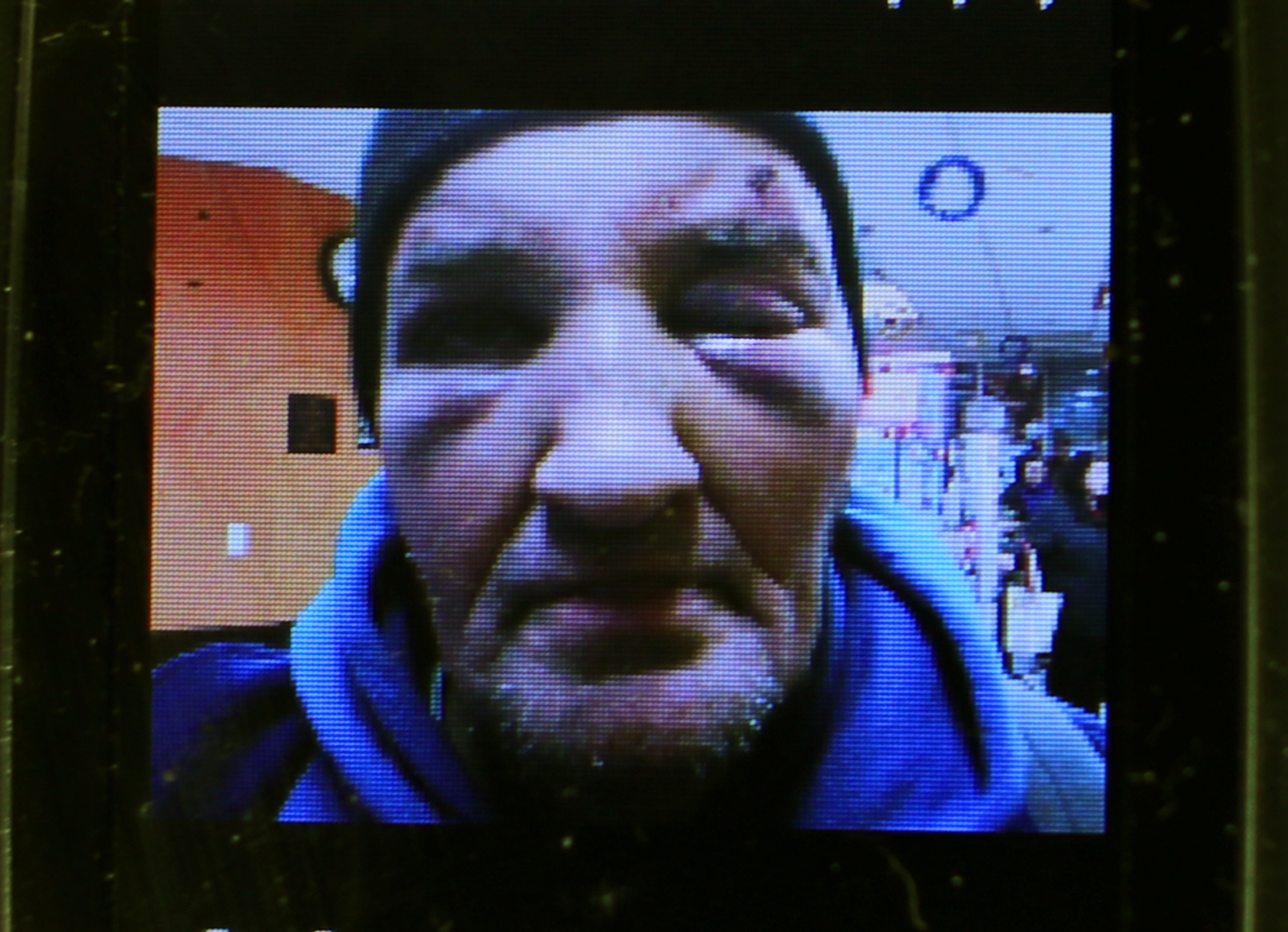 A cellphone photo of Michael Hathaway’s injuries.