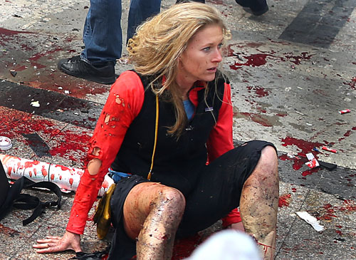 The image of a shocked and injured Nicole Gross came to symbolize the Marathon bombings.