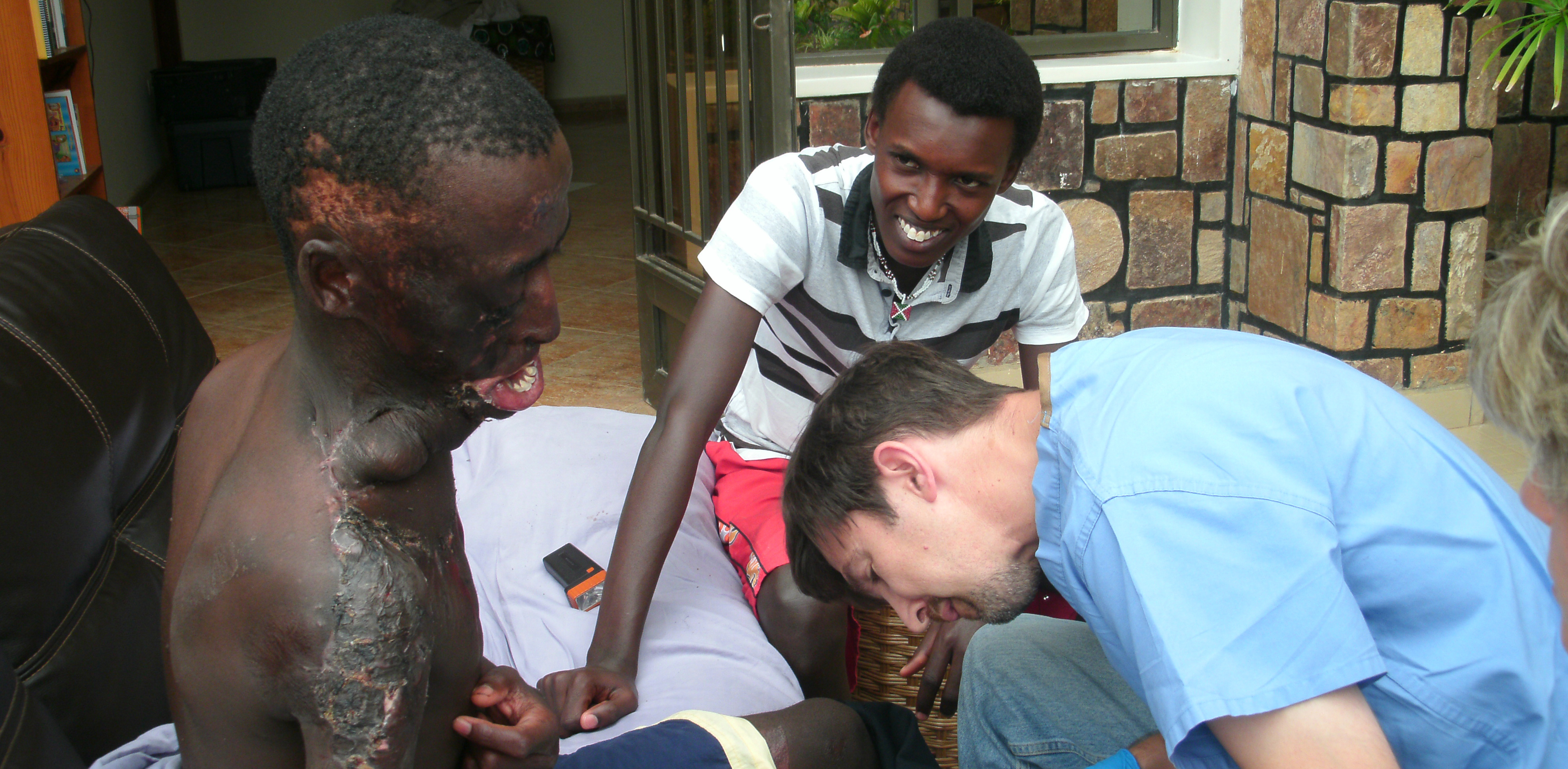 Before helping Leo, Alex aided another burn victim, Freddy Uwizeyimana, shown getting medical care in Rwanda with Alex.