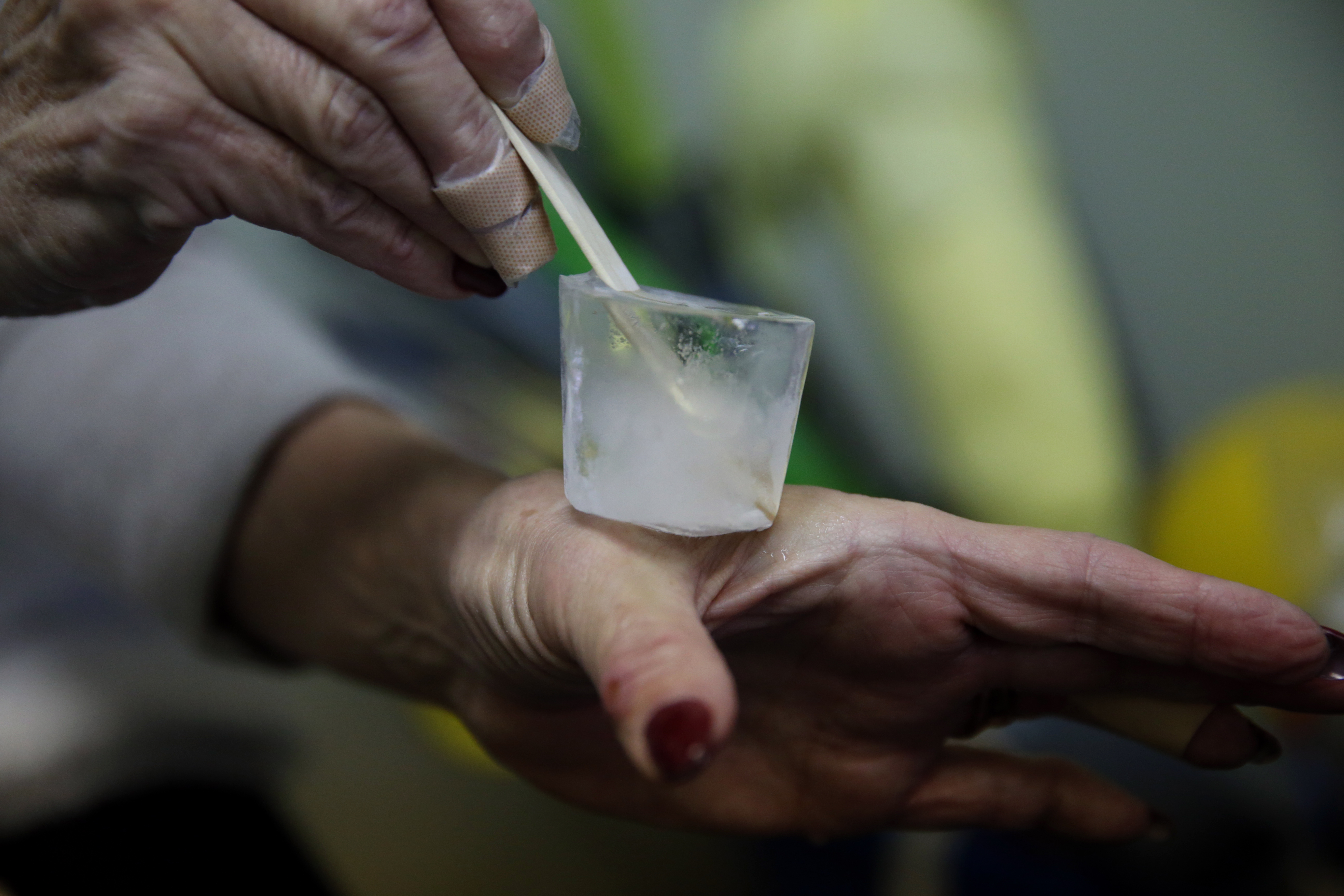 Pain pops — paper cups of ice with a Popsicle stick inside — help Karen Hanlon manage her pain by soothing a nerve that runs up her arm.