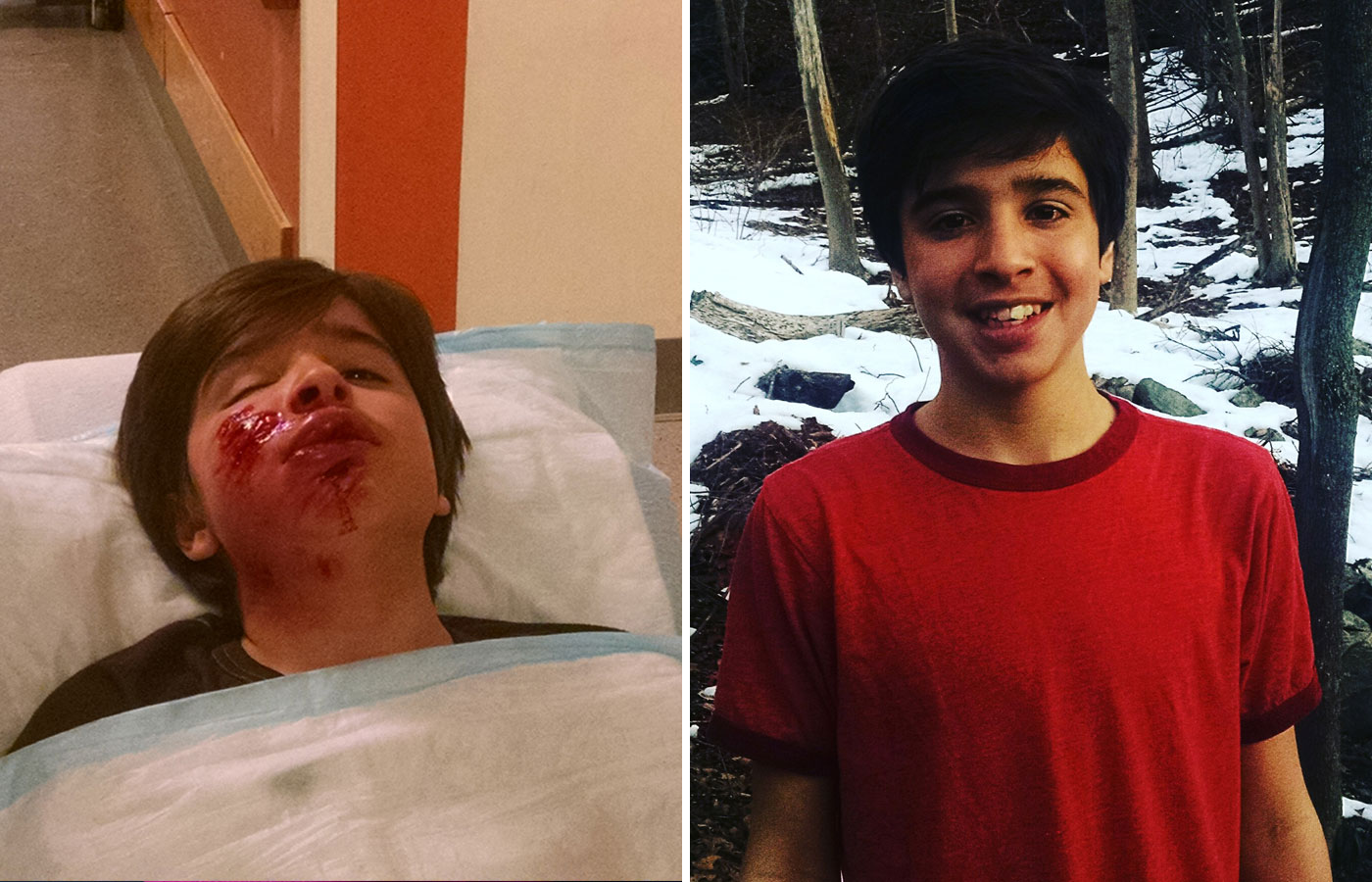 Beckett while being treated at Winchester Hospital (left) and more than a year later (right).