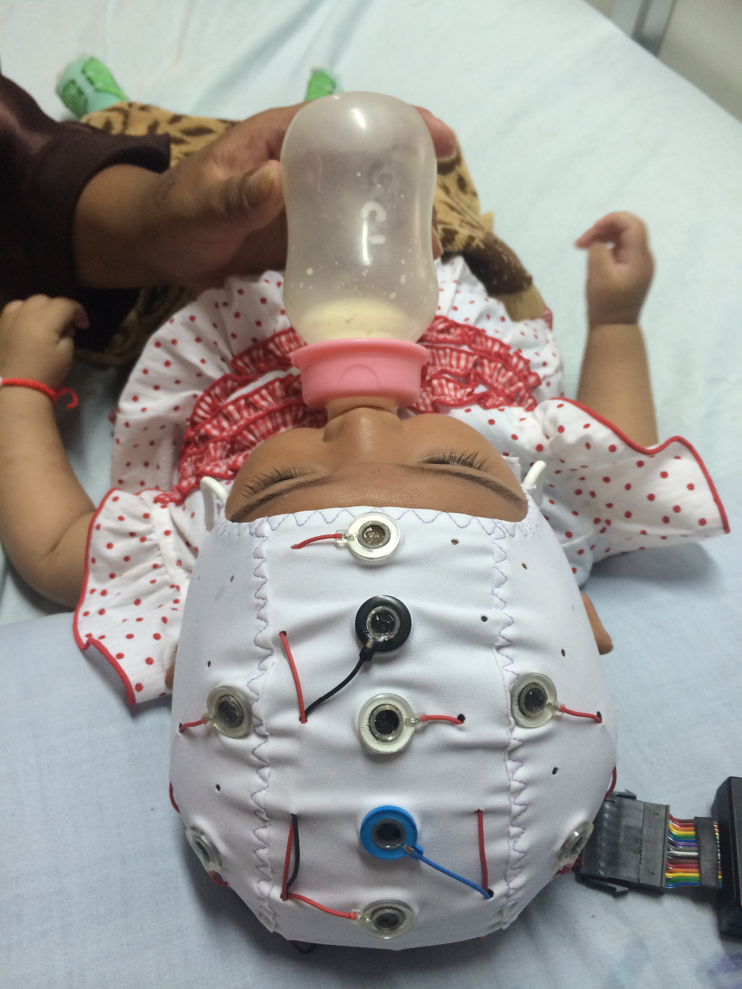 An infant wears a cap with a headset that enables a smartphone to make a diagnosis.